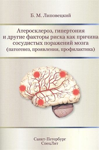 Липовецкий Б. Атеросклероз, гипертония, и другие факторы риска как причина сосудистых поражений мозга (патогенез, проявления, профилактика)