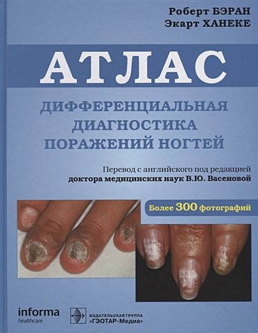 Бэран Р., Ханеке Э. Атлас. Дифференциальная диагностика поражений ногтей атлас дифференциальная диагностика поражений ногтей