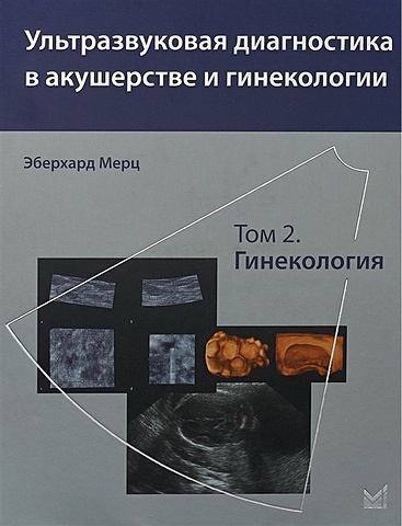 Мерц Э. Ультразвуковая диагностика в акушерстве и гинекологии. Том 2. Гинекология ультразвуковая диагностика в акушерстве и гинекологии в 2 х томах том 1 акушерство 2 е издание