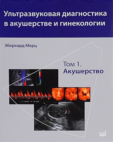 Мерц Э. Ультразвуковая диагностика в акушерстве и гинекологии. Том 1. Акушерство ультразвуковая диагностика в акушерстве и гинекологии в 2 х томах том 2 гинекология 2 е издание мерц э