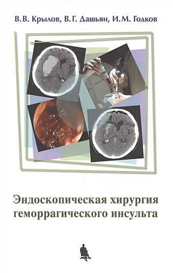Крылов В., Дашьян В., Годков И. Эндоскопическая хирургия геморрагического инсульта крылов в ред эндоскопическая нейрохирургия