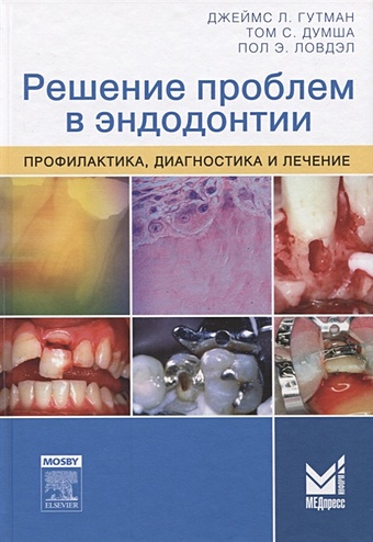 Гутман Дж., Думша Т., Ловдэл П. Решение проблем в эндодонтии 4 шт кор стоматологическая стоматологическая эндо файлы эндодонтической терапии конденсатор с фокусным расстоянием 25 мм macspadden конденсато
