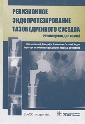 Джакофски Д., Хэдли Э. (ред.) Ревизионное эндопротезирование тазобедренного сустава. Руководство для врачей