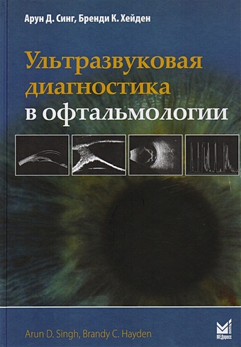 ультразвуковая диагностика в офтальмологии 2 е издание синг а д Синг А., Хейден К. Ультразвуковая диагностика в офтальмологии