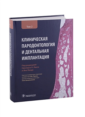 Ланга П. (ред.) Клиническая пародонтология и дентальная имплантация . В 2-х томах. Том 2