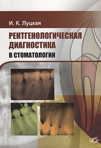 Луцкая И. Рентгенологическая диагностика в стоматологии рентгенодиагностика заболеваний зубов и челюстей с атласом рентгенограмм