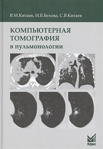 Китаев В., Белова И., Китаев С. Компьютерная томография в пульмонологии