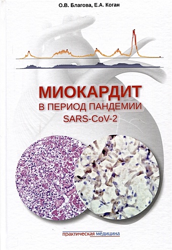 Благова О.В., Коган Е.А. Миокардит в период пандемии SARS-CoV-2
