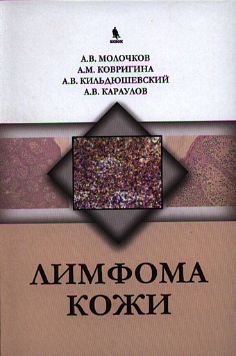 Молочков А., Ковригина А., и др. Лимфома кожи