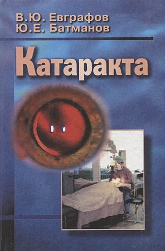 катаракта глаукома Катаракта