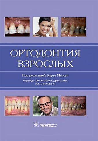Мелсен Б. (ред.) Ортодонтия взрослых руководство по клиническому обследованию больного
