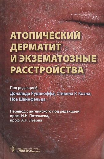 Рудикофф Д., Коэн С., Шайнфельд Н. (ред.) Атопический дерматит и экзематорные расстройства
