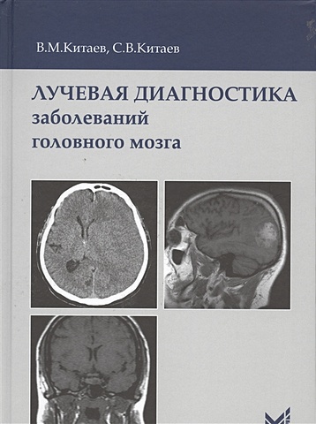 Китаев В., Китаев С. Лучевая диагностика заболеваний головного мозга труфанов г е совмещенная пэт кт в диагностике опухолей головного мозга от морфологии к функции