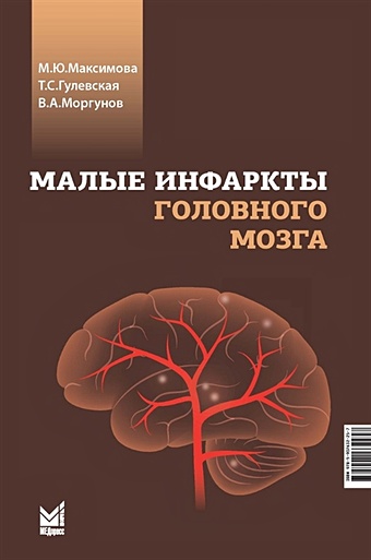 Максимова М.Ю., Гулевская Т.С., Моргунов В.А. Малые инфаркты головного мозга