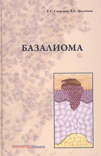 Снарская Е., Молочков В. Базалиома