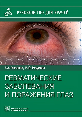 Годзенко А.А.,Разумова И.Ю. Ревматические заболевания и поражения глаз: руководство для врачей