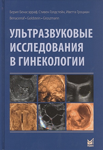 Бенасэрраф Б., Голдстейн С., Гроцман И. Ультразвуковые исследования в гинекологии