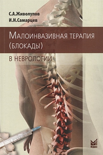 Живолупов С., Самарцев И. Малоинвазивная терапия (блокады) в неврологии