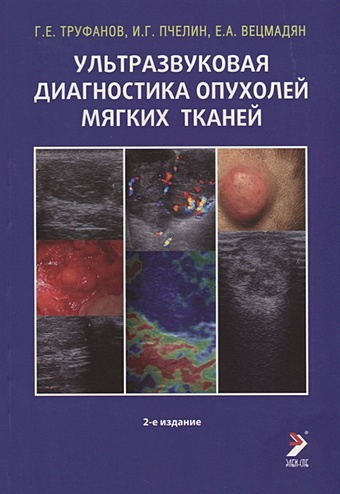 ультразвуковая диагностика в офтальмологии 2 е издание синг а д Труфанов Г., Пчелин И., Вецмадян Е. Ультразвуковая диагностика опухолей мягких тканей