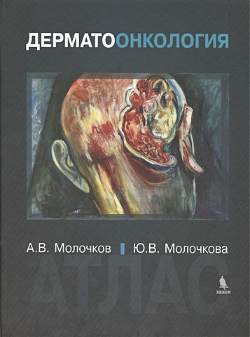 Молочков А., Молочкова Ю. Дерматоонкология. Атлас