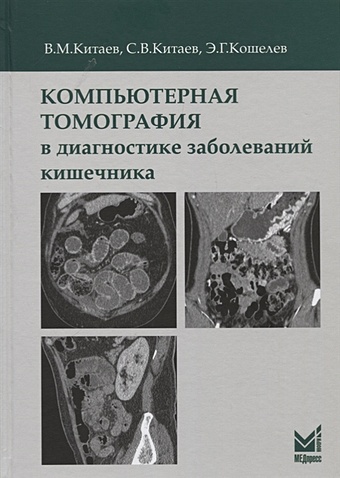 Китаев В., Китаев С., Кошелев Э. Компьютерная томография в диагностике заболеваний кишечника
