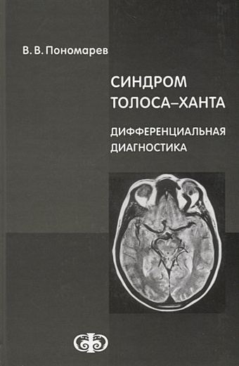 Пономарев В. Синдром Толоса-Ханта. Дифференциальная диагностика дощицин в электрокардиографическая дифференциальная диагностика