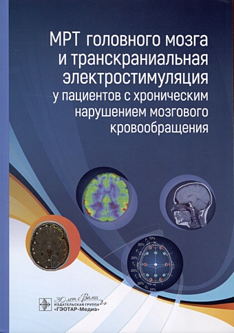Морозова Т.Г., Борсуков А.В., Чухонцева Е.С. и др. МРТ головного мозга и транскраниальная электростимуляция у пациентов с хроническим нарушением мозгового кровообращения