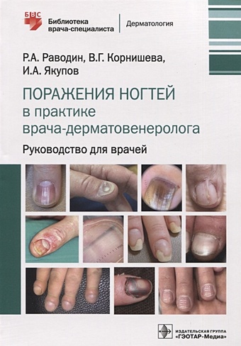 Раводин Р., Корнишева В., Якупов И. Поражения ногтей в практике врача-дерматовенеролога: руководство для врачей