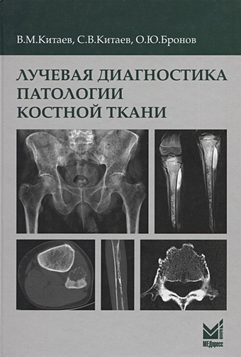 Китаев В., Китаев С., Бронов О. Лучевая диагностика патологии костной ткани