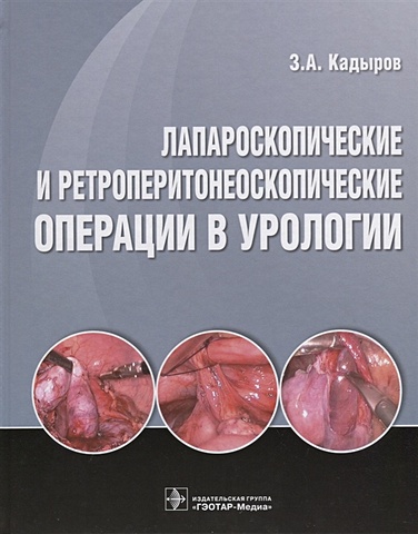 Кадыров З. Лапароскопические и ретроперитонеоскопические операции в урологии