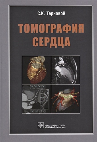 Терновой С. Томография сердца