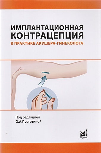Пустотина О. (ред.) Имплантационная контрацепция в практике акушера-гинеколога тор видеманн сабина контрацепция естественный метод