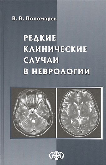 Пономарев В. Редкие клинические случаи в неврологии. Руководство для врачей