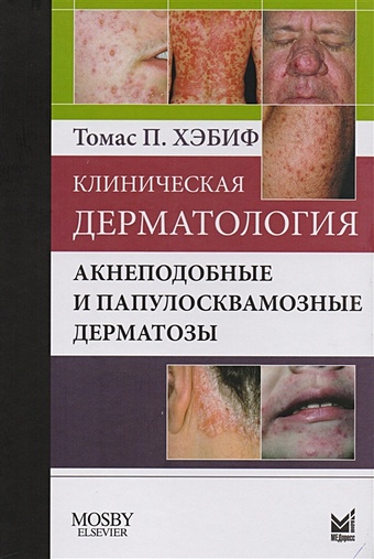Хэбиф Т. Клиническая дерматология. Акнеподобные и папулосквамозные дерматозы