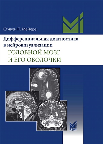 Мейерз С.П. Дифференциальная диагностика в нейровизуализации. Головной мозг и его оболочки мейерз с п дифференциальная диагностика в нейровизуализации позвоночник и спинной мозг