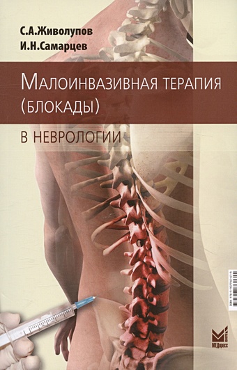 Живолупов С.А., Самарцев И.Н. Малоинвазивная терапия (блокады) в неврологии
