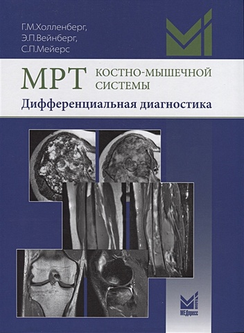 Холленберг Г., Вейнберг Э., Мейерс С. МРТ костно-мышечной системы. Дифференциальная диагностика лучевая диагностика травмы костно мышечной системы бланкенбейкер донна г дэвис киркленд у