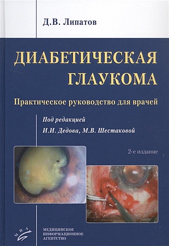 Липатов Д. Диабетическая глаукома: Практическое руководство для врачей диабетическая микроангиопатия