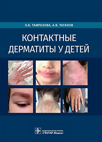 Тамразова О., Таганов А. Контактные дерматиты у детей