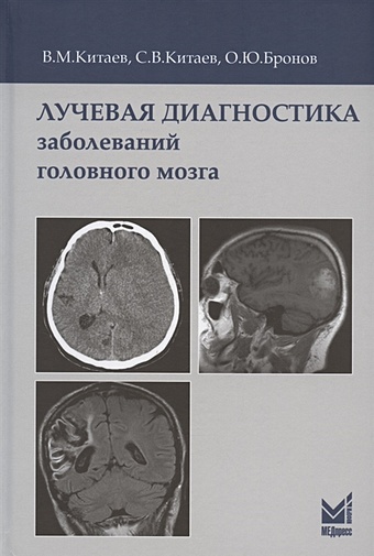 цена Китаев В., Китаев С., Бронов О. Лучевая диагностика заболеваний головного мозга. 3-е издание