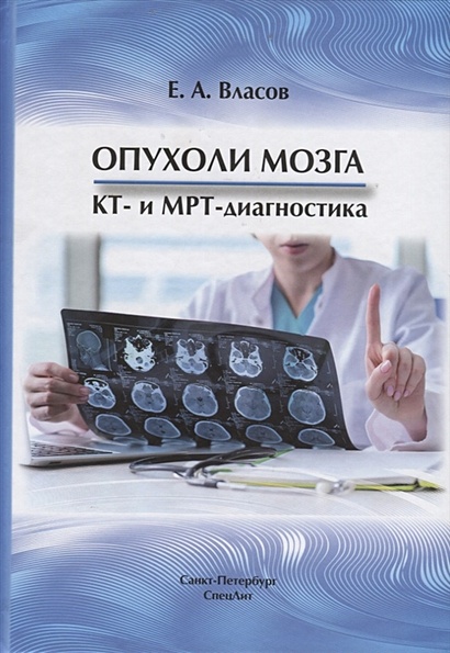 Опухоли мозга. КТ и МРТ- диагностика - фото 1
