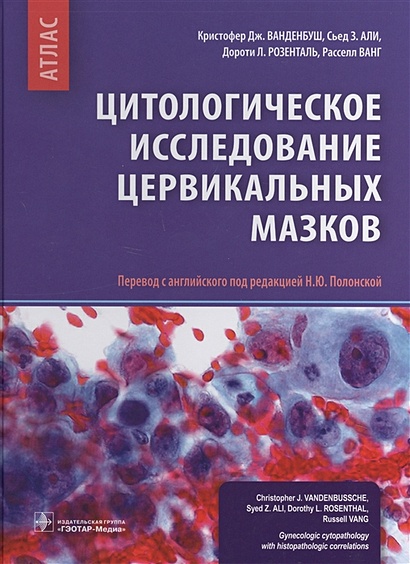 Гинекологические мазки атлас фото