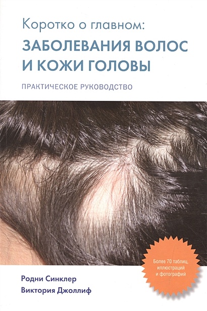 Коротко о главном: заболевания волос и кожи головы - фото 1