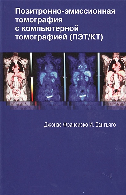 Позитронно-эмиссионная томография с компьютерной томографией (ПЭТ/КТ) - фото 1