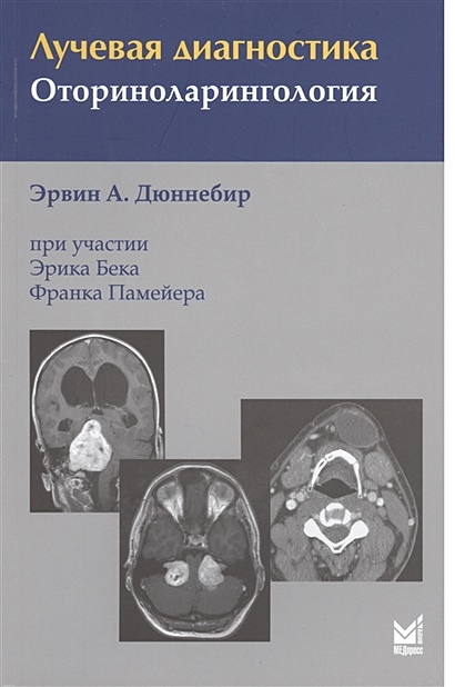 Книга Лучевая Диагностика. Оториноларингология • Дюннебир Э.