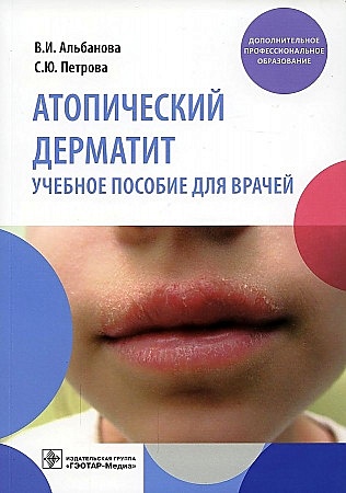 Атопический дерматит. Учебное пособие для врачей - фото 1