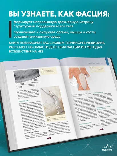 Fascia. Что это такое и почему это важно - фото 6