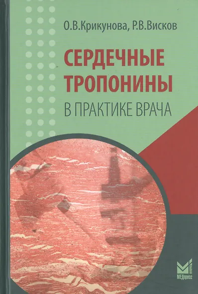 Сердечные тропонины в практике врача - фото 1