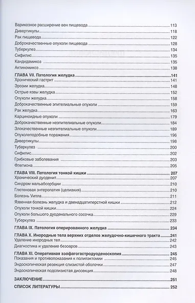 Эндоскопическая диагностика и лечение заболеваний пищевода, желудка и тонкой кишки - фото 3