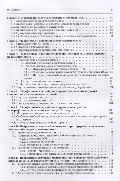 Нейрофизиологический интраоперационный мониторинг в нейрохирургии - фото 3